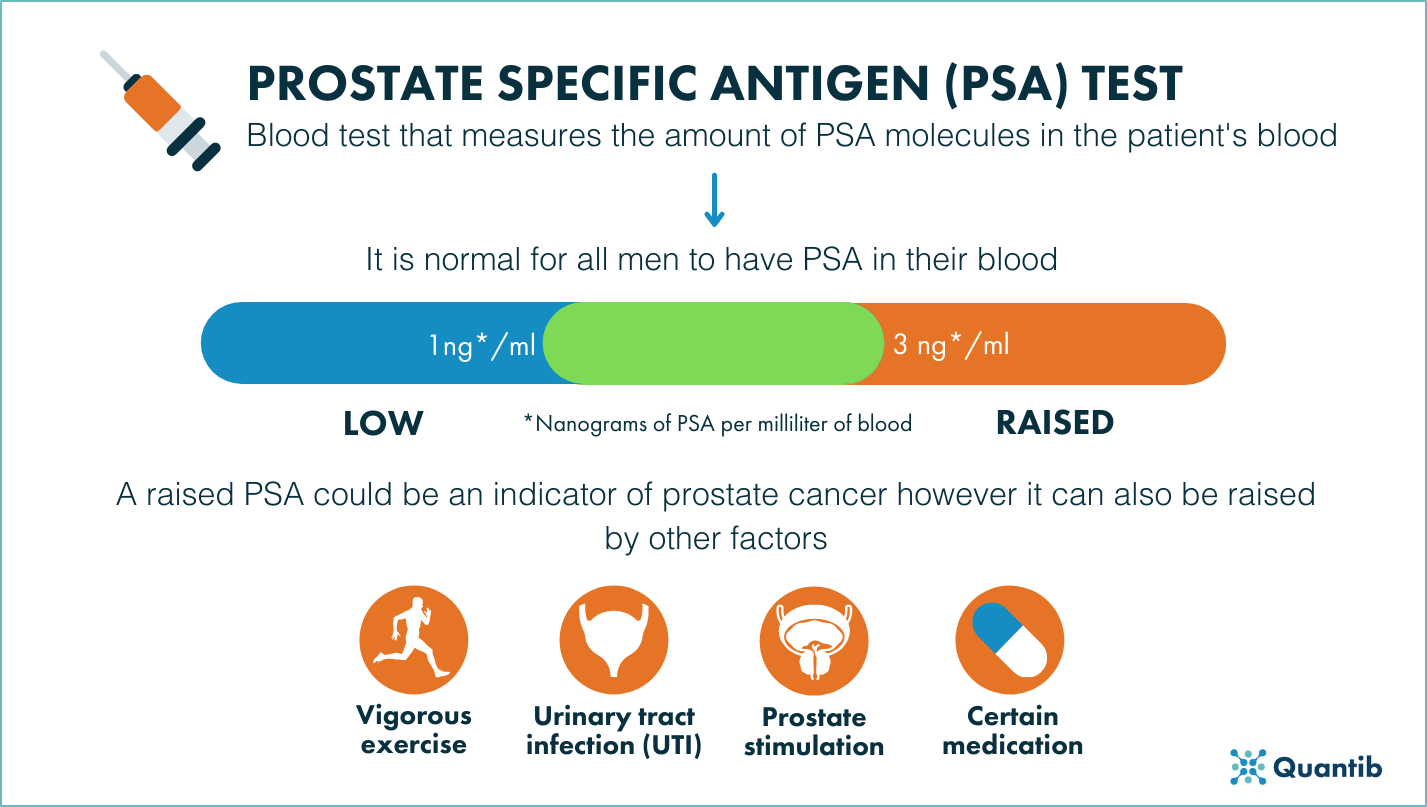 How Can Urologists Improve Patient Care In The Prostate Cancer Pathway   210831   PSA Test Infographic 